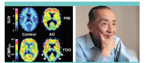 Une chaire axée sur le recherche sur la Maladie d'Alzheimer